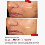 Niacinamide Tone Booster