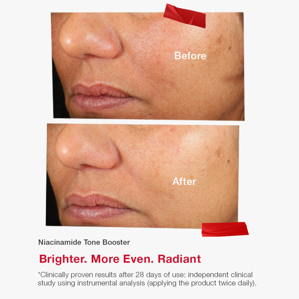 Niacinamide Tone Booster – Image 5