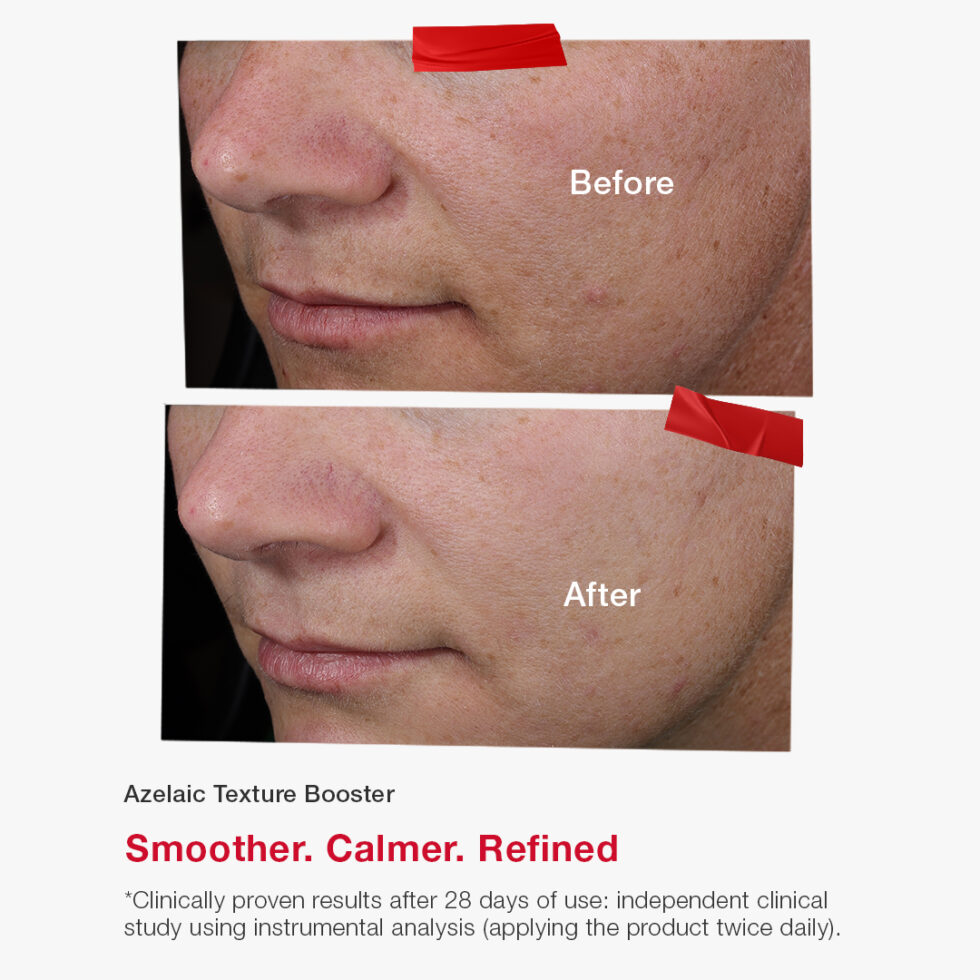 Azelaic Texture Booster - Image 6